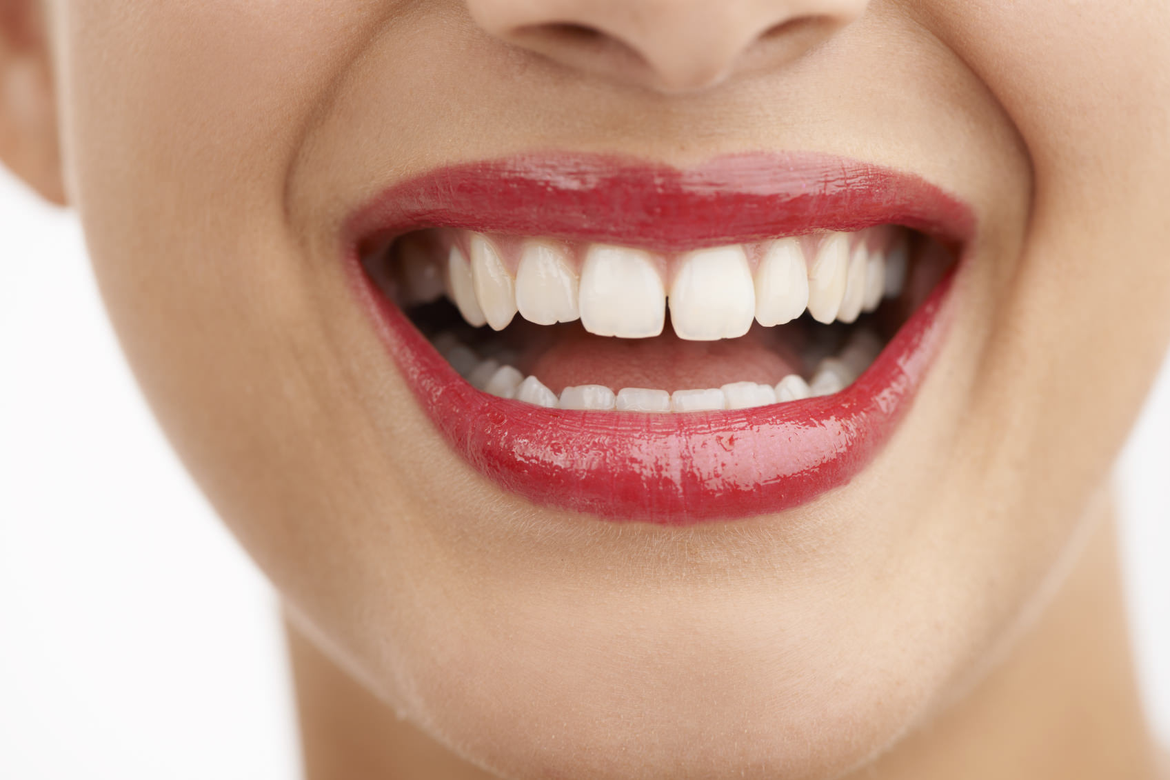 Diastema: ¿cómo corregir los dientes separados?