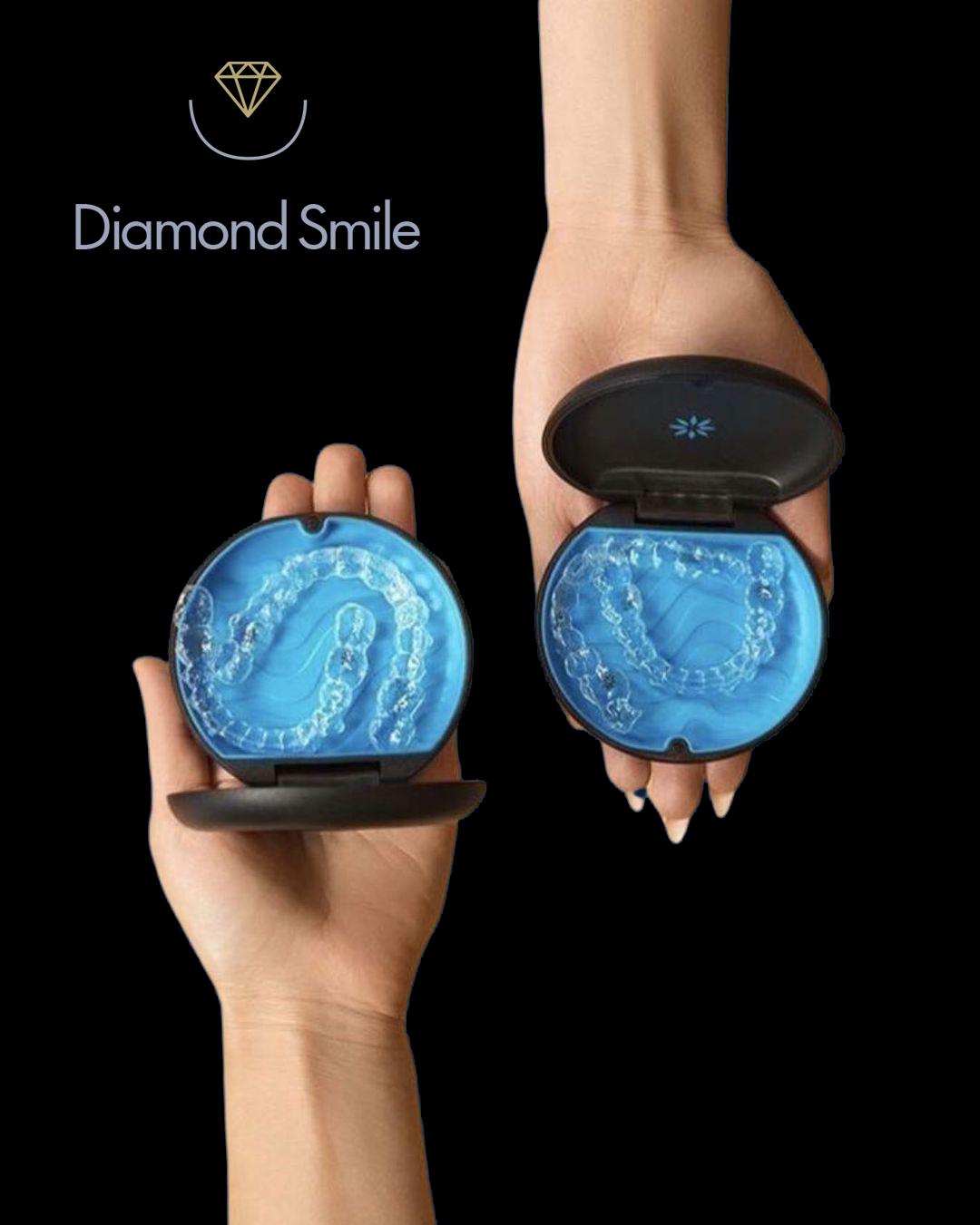 diamond smile invisalign