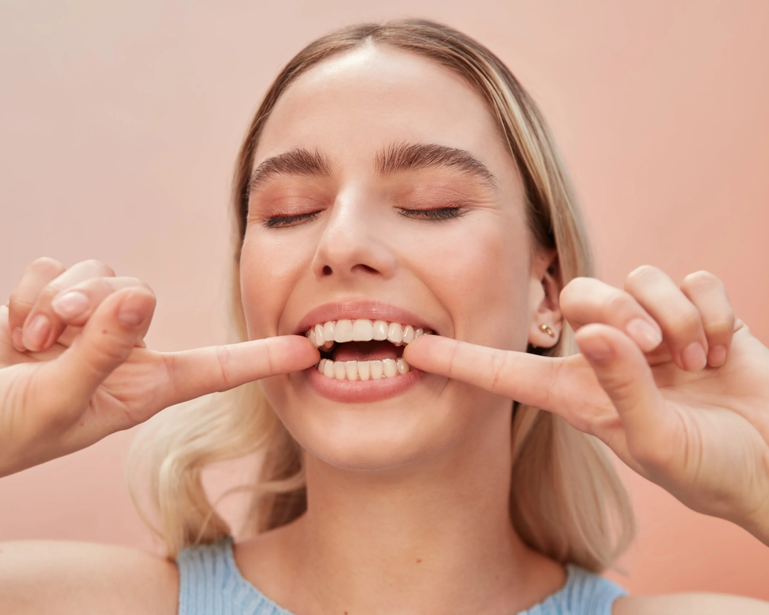 Retenedores dentales: ¿qué son y para qué sirven?