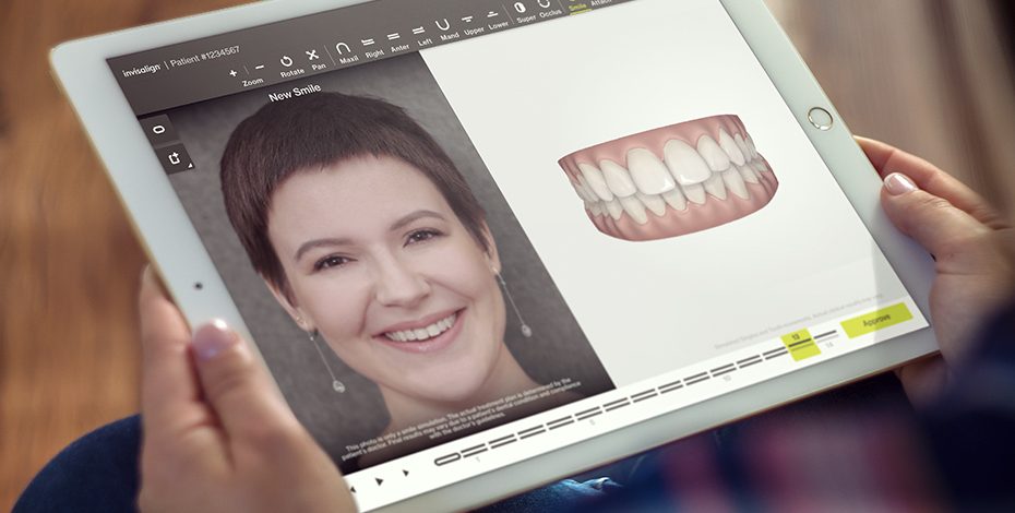 ¿En qué consiste el ClinCheck de Invisalign?