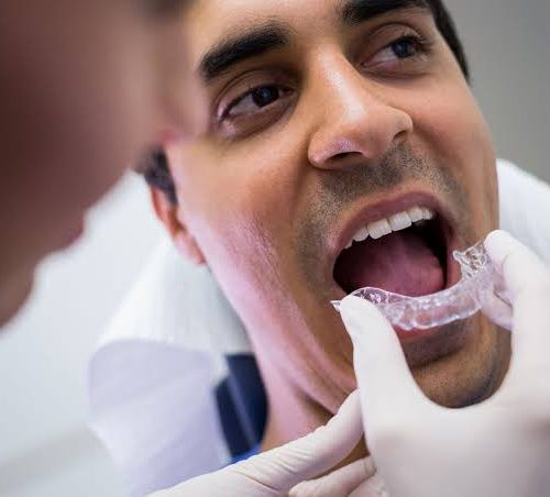 invisalign adultos mas de 40 años