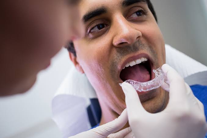 invisalign adultos mas de 40 años