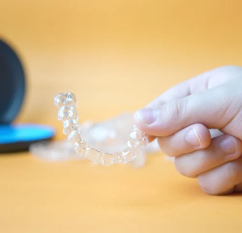 invisalign madrid como elegir clinica